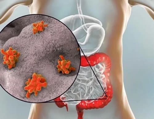 Vermixin È di buona qualità