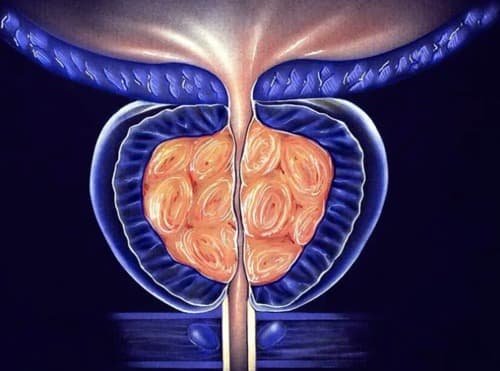 ProstActive È di buona qualità